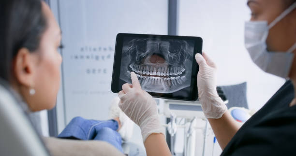Licensed Dental Implants service in Lone Star, TX - Smile Center Dentistry